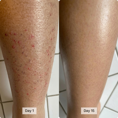 Skrub™ Korean Exfoliating Shower Towel
